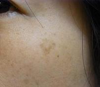 ラ ロッシュ ポゼ　皮膚科医が採用する敏感肌のためのスキンケア３.jpg